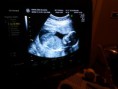 /album/mundo-ecografico/a2012-01-18-14-40-40-jpg/